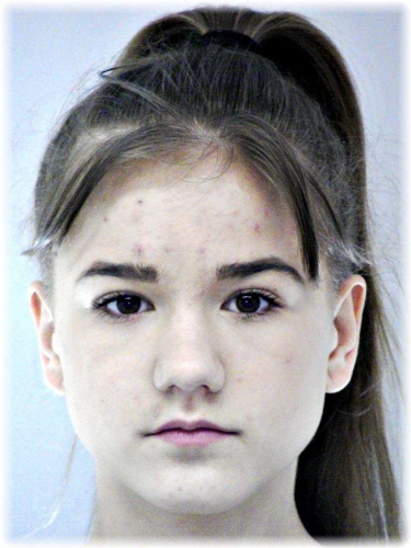 kép